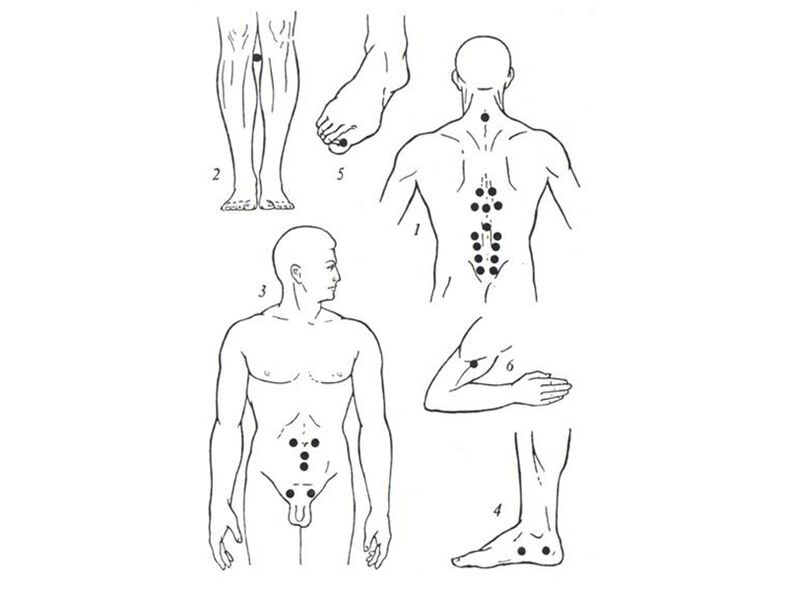 Acupuncture massage